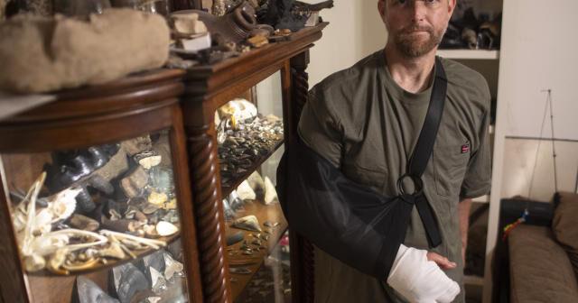 Diver pinned under water by an alligator figured he had choice: Lose his arm or lose his life - Vimarsana News