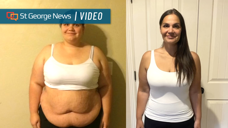 hers glp 1 before and after After losing 160 pounds, St. George woman becomes advocate for GLP-1  medications | Health and Wellness