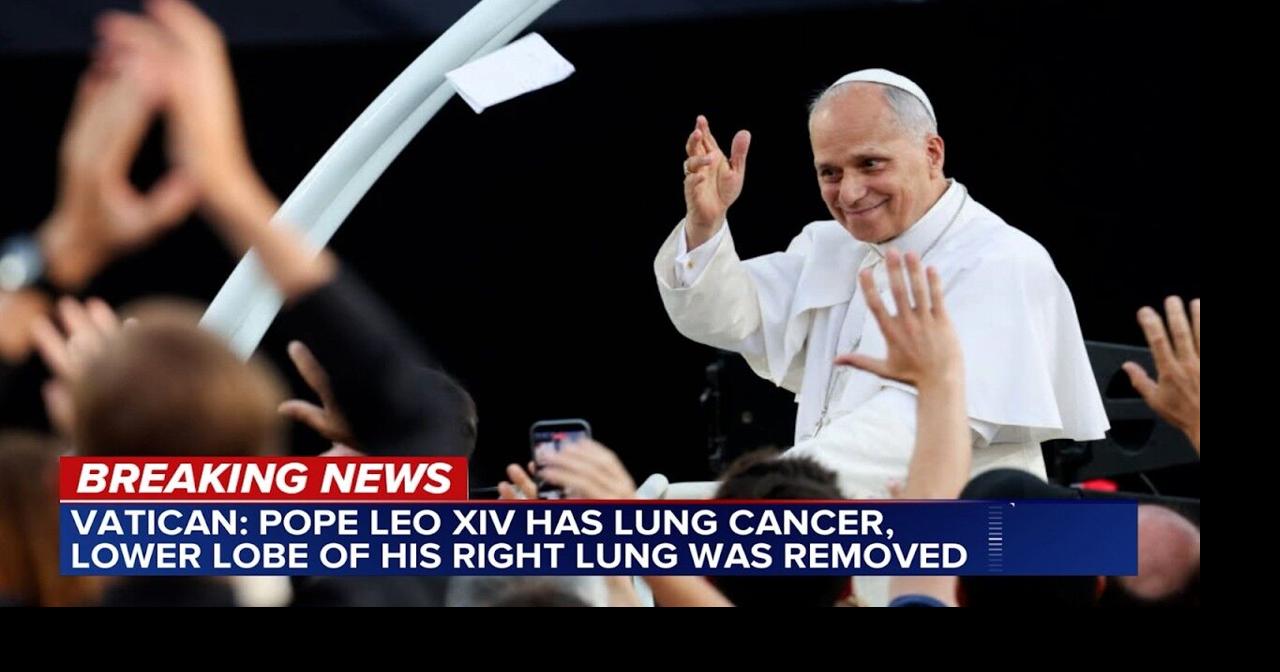 Pope Leo XIV has lung cancer, Vatican says | National/World ...