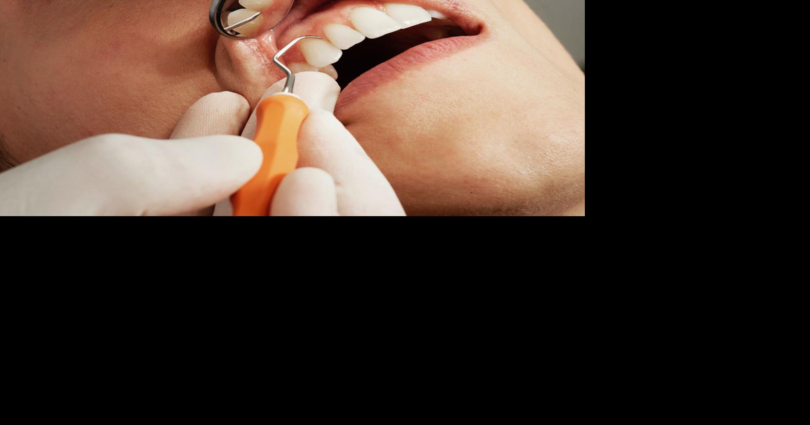 Prevention of gum disease can lead to better health | Health