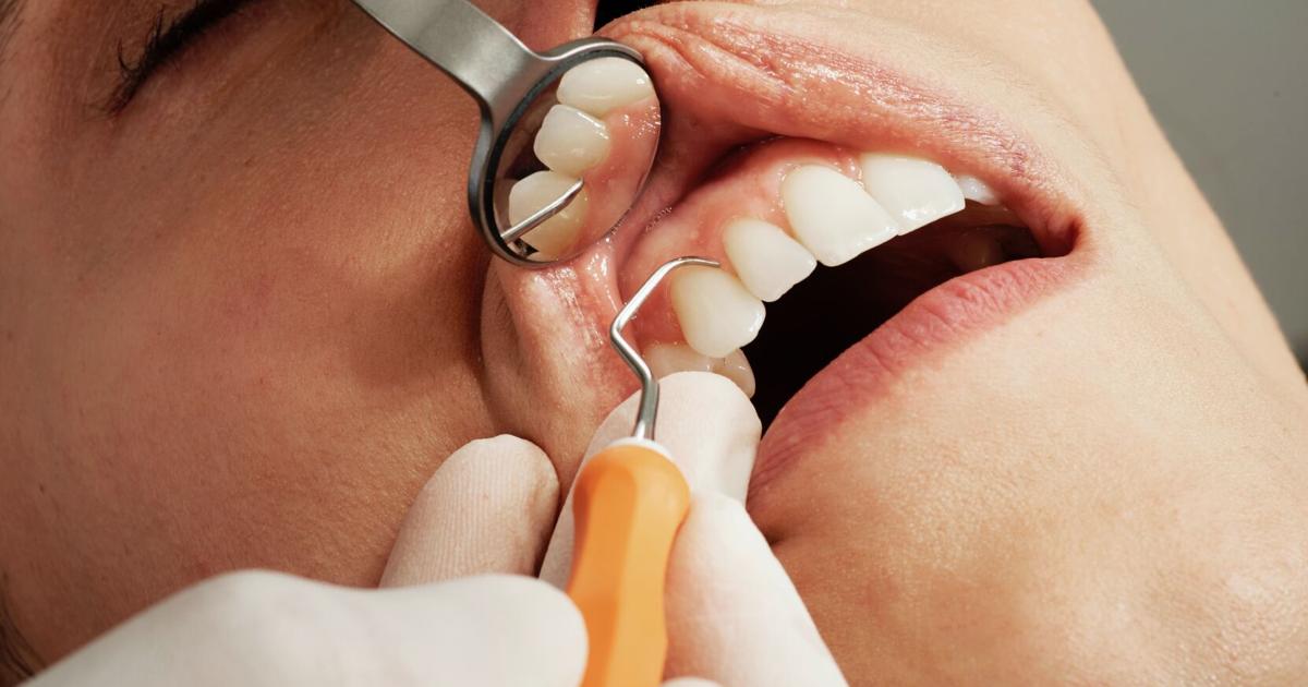 Prevention of gum disease can lead to better health | Health Prevention of gum disease can lead to better health | Health