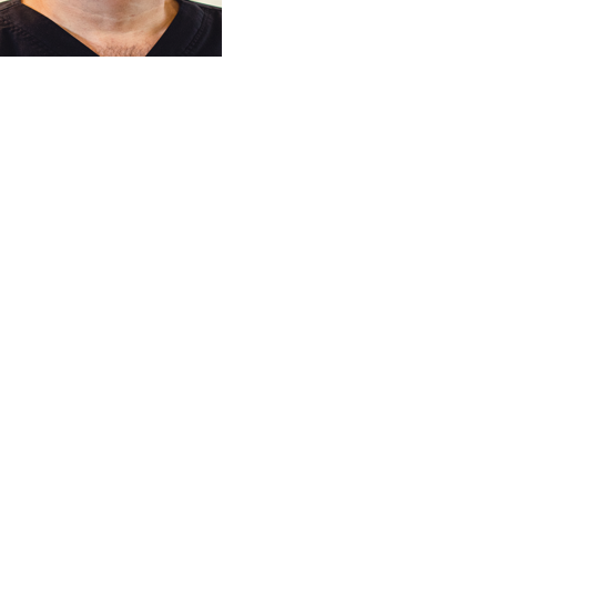 Why dental implants are a great choice to restore smile | Guest Columns