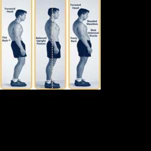 Perfect posture promotes a healthy spine | Find this article in the CJN ...