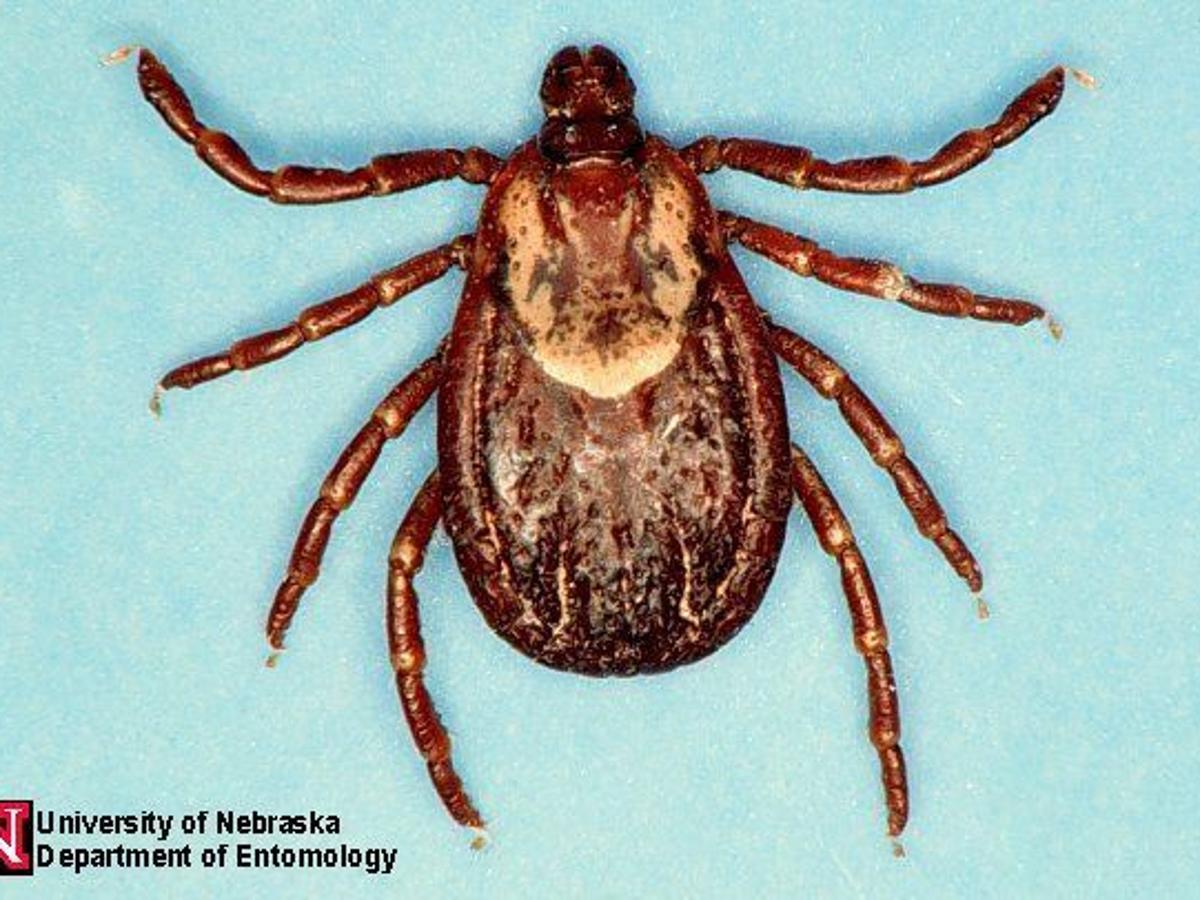 Silver Creek Girl Still Suffering From Tick Bite Local Columbustelegram Com Silver Creek Girl Still Suffering From Tick Bite Local Columbustelegram Com