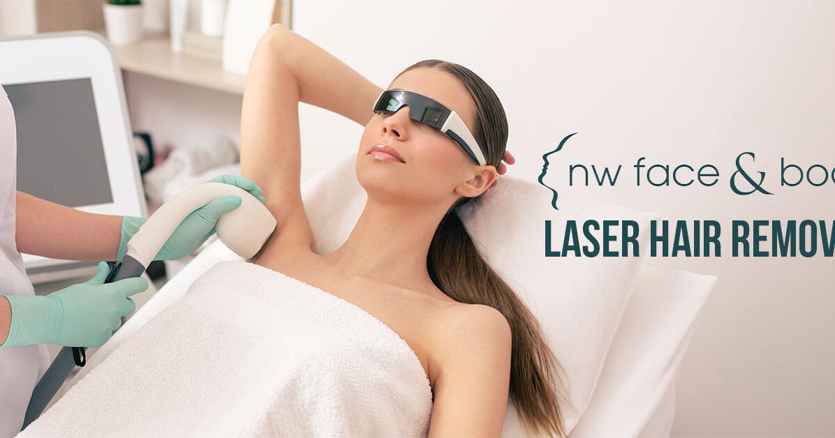 Who Does the Best Laser Hair Removal in Bellevue, WA?
