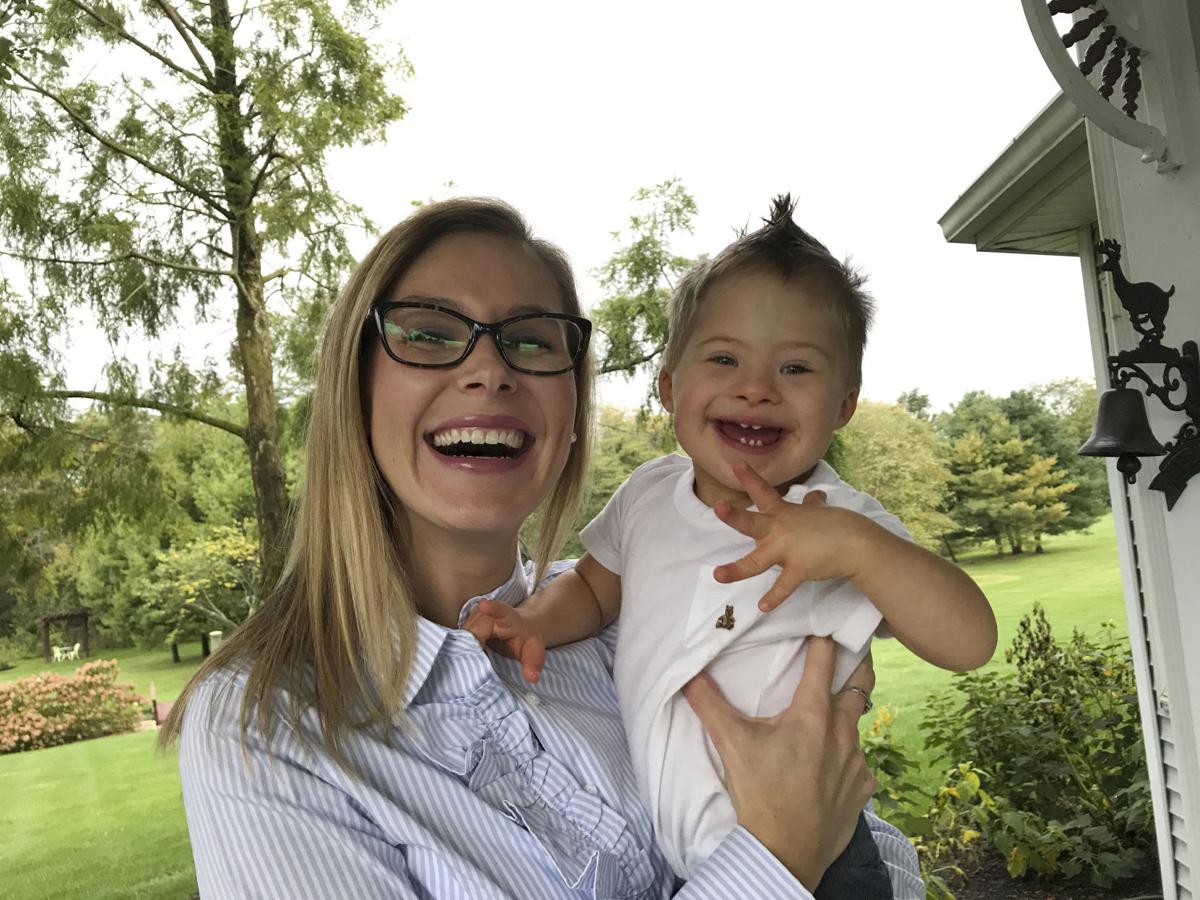 Down Syndrome Abortion
