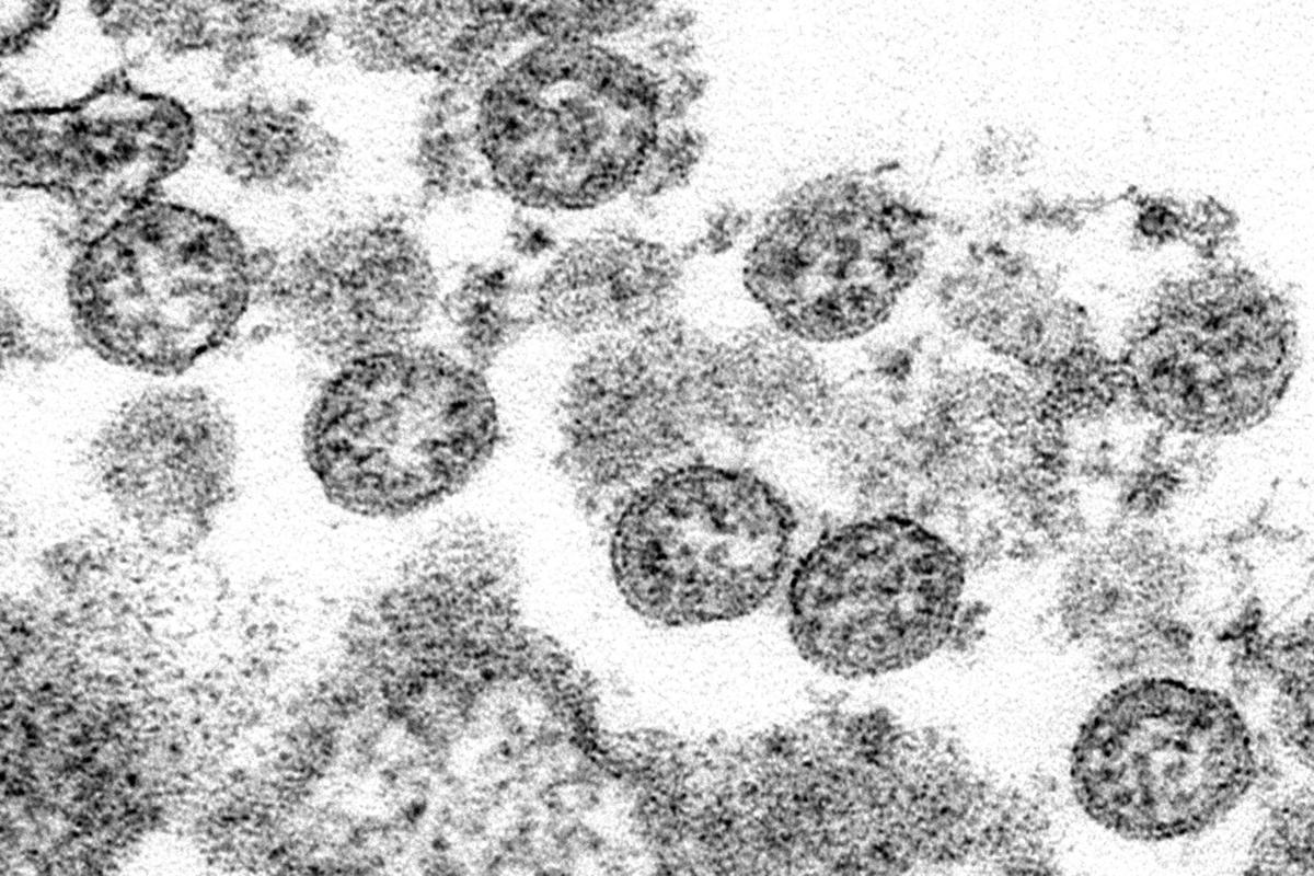 Virus Outbreak - Inflammatory Condition