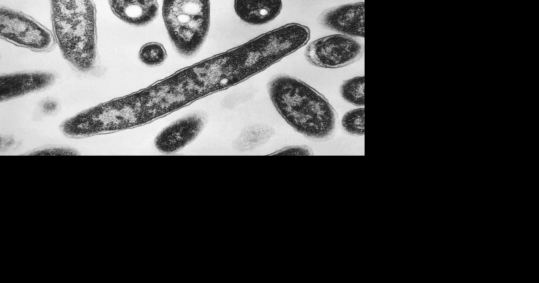 First death reported in Legionnaires' disease outbreak in New York City ...