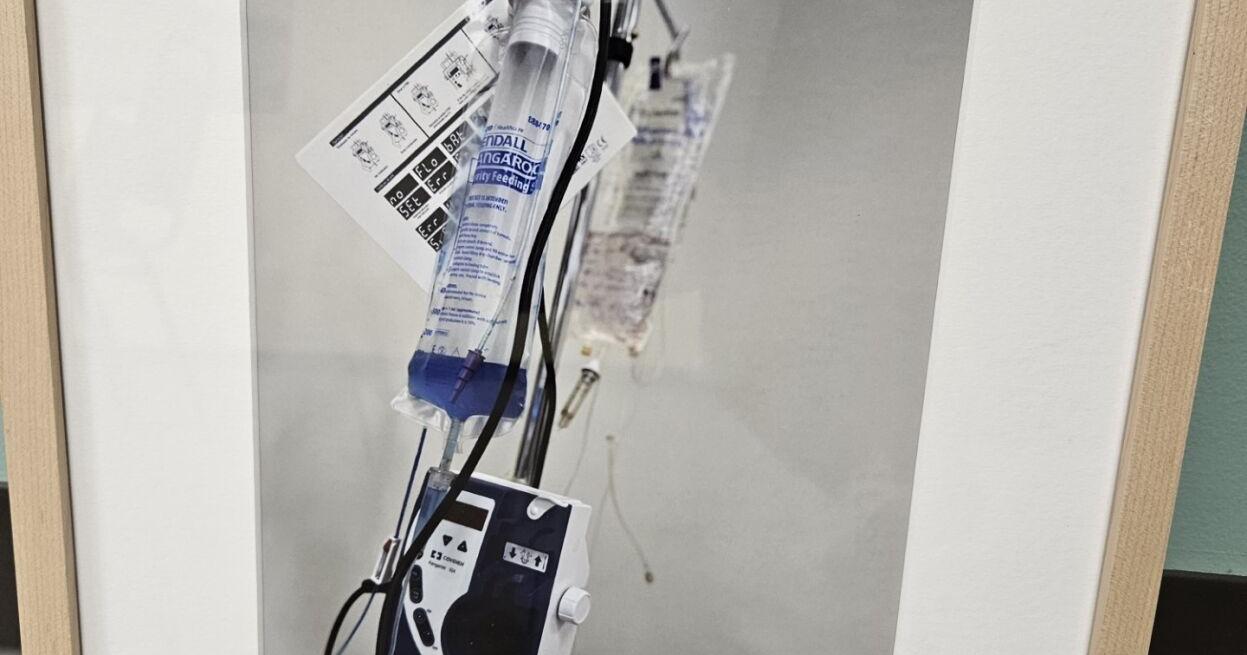 Cancer in Appalachia examined in art exhibit, book - Vimarsana News