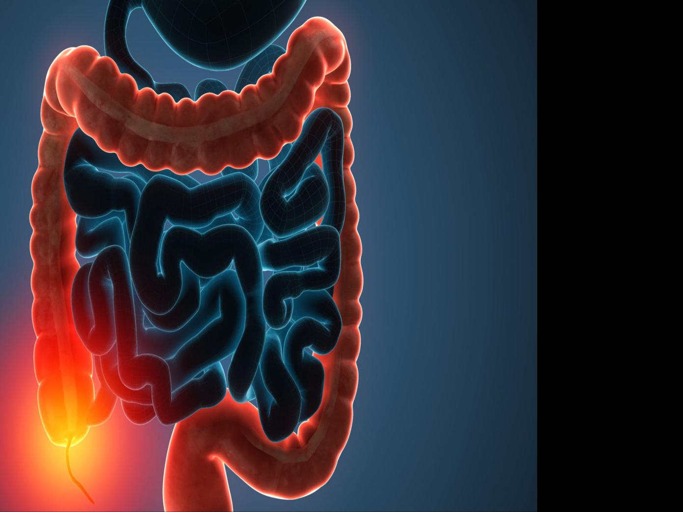 What You Can Expect With A Colonoscopy Health Dailyitem Com