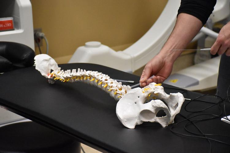 Coccyx Rfa Radiofrequency ablation a way to manage chronic pain | Lifestyles ...