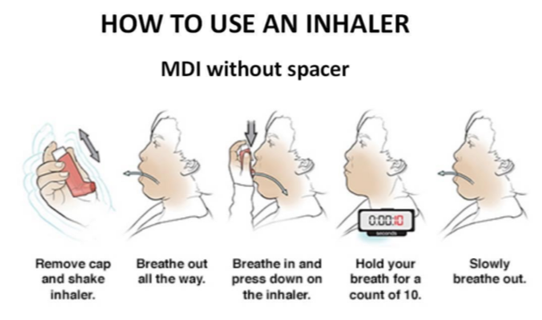 Control Asthma, Enjoy Life | News | dailypost.vu