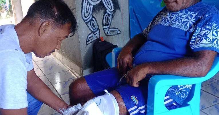 First casting on 8 amputees on Tanna - Vimarsana News