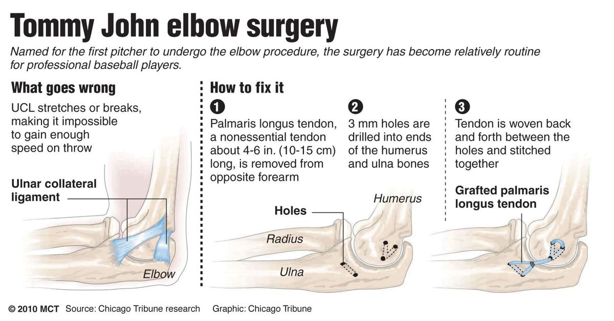 Every pitch counts: Local leagues, coaches aim to protect ...