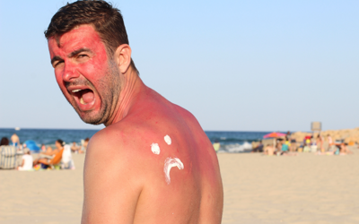 Avoid Sunburn and Skin Damage With These Top 13 Sun Care Products From Amazon