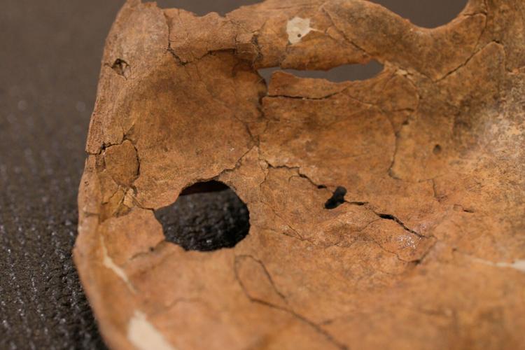 The left scapula of the Neanderthal individual called Shanidar A who lived about 75,000 years ago