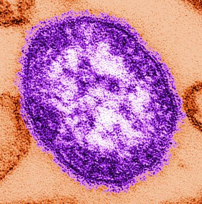 Original Title: 4424-measles-single particle
