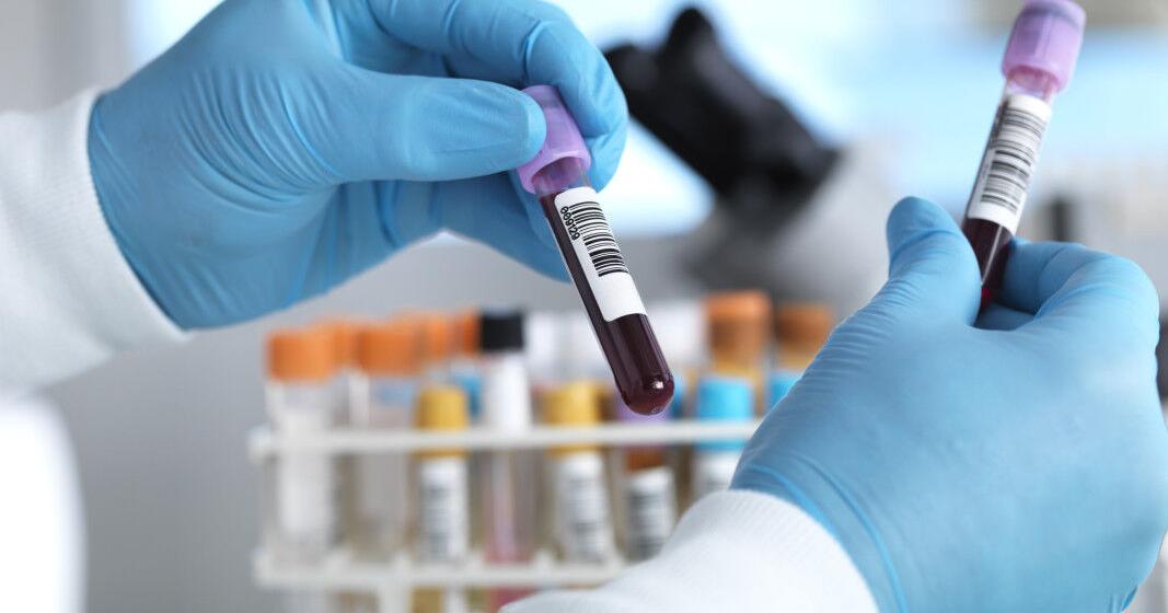 This 'Forgotten' Blood Test Can Catch Cancer Early