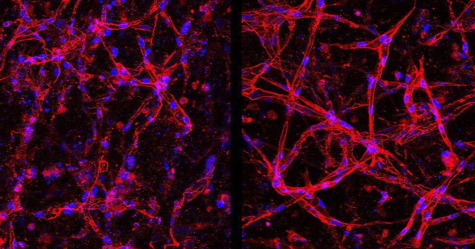 Stem cell breakthrough offers fresh hope for treating blindness