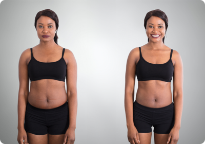10weightlossmedsimage1