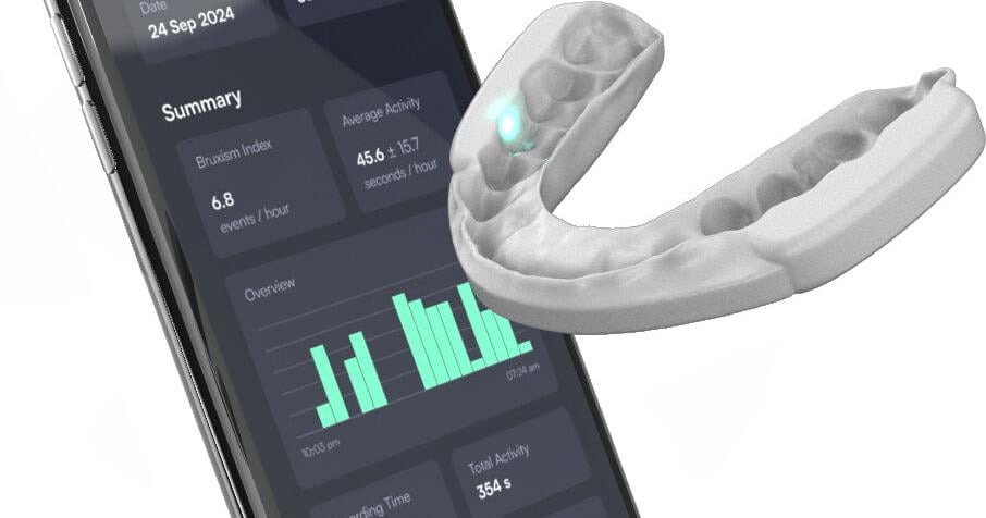 Aesyra démontre une réduction significative du bruxisme du sommeil dans une étude clinique