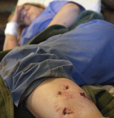 shotgun to halt pit bull attack