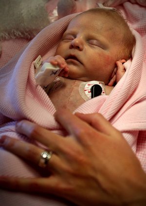 Newborn undergoes rare heart procedure 