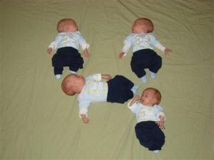 identical quadruplet babies