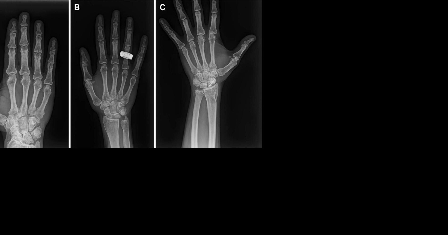 Diagnostic Accuracy and Performance