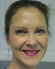 Ivy Filson, Licensed Medical Aesthetician