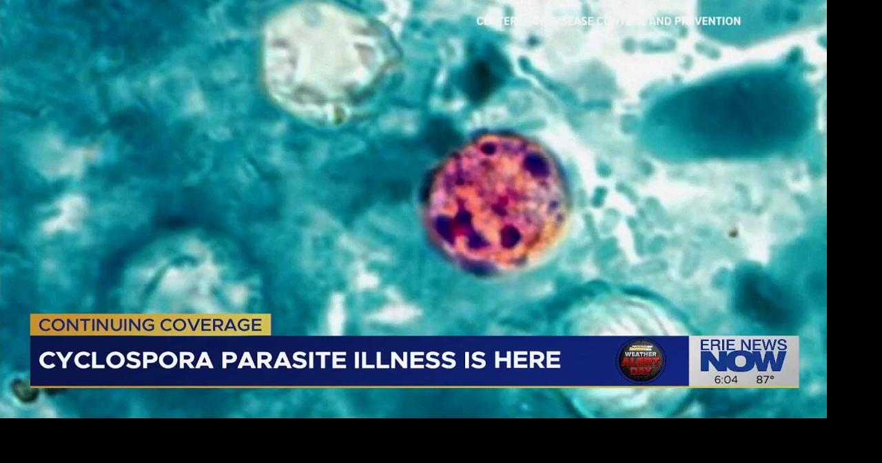 Health Officials Warn of Cyclospora Cases as Suspected Foodborne Illness Appears in Erie County