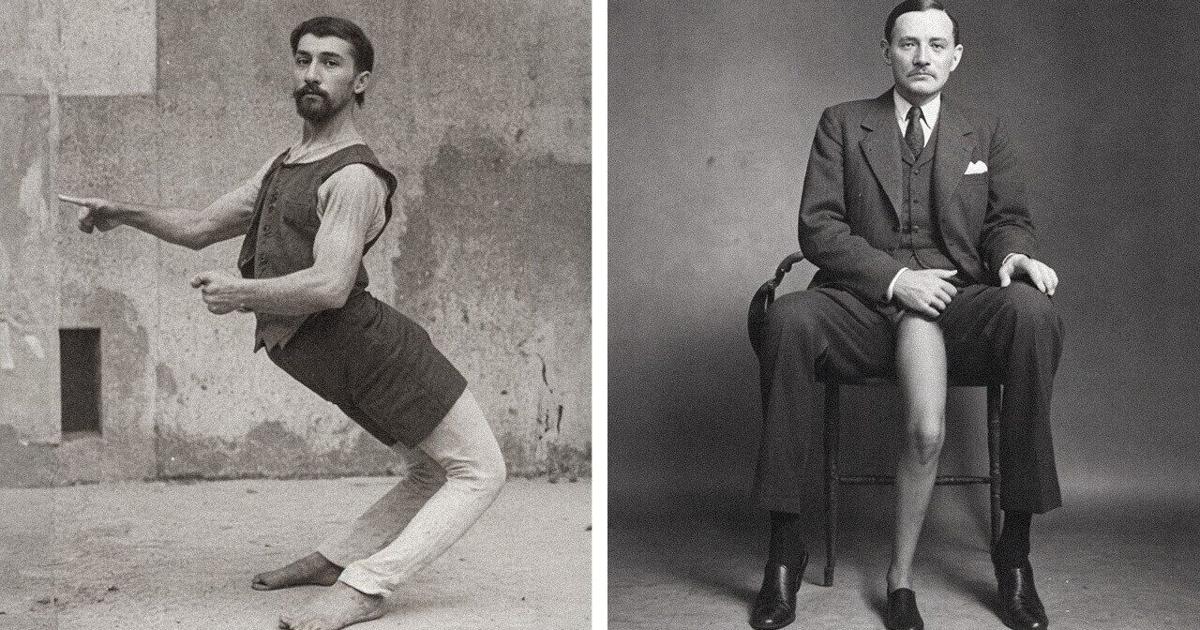 Three Man Leg Pattern How the Three-Legged Man Became a Superstar | Videos | fltimes.com