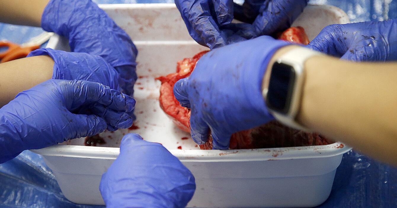 Anatomy for young folks: 'I want to be a zoologist' says a fourth-grader during a hands-on dissection of pig hearts | News - Vimarsana News
