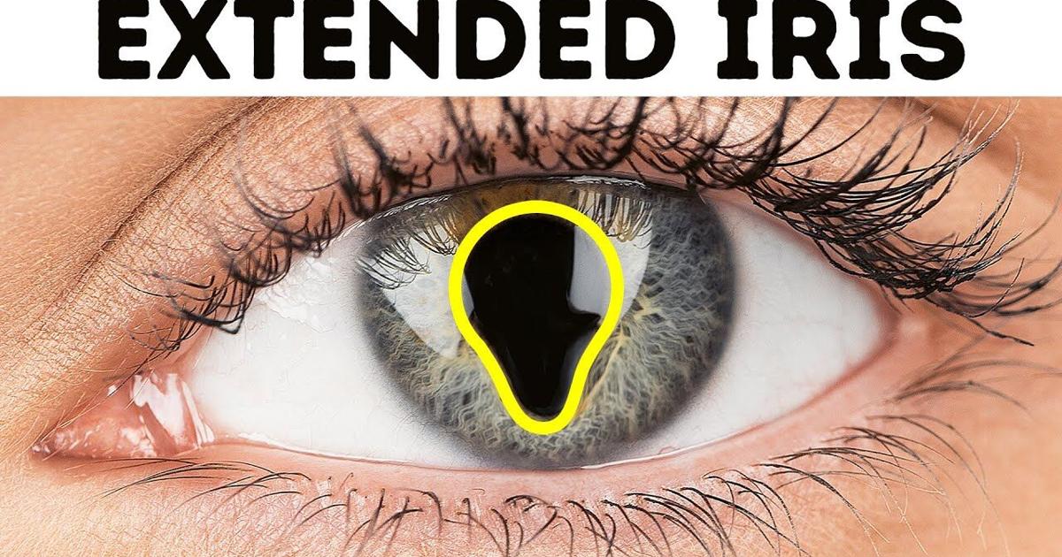 30+ Rarest Body Features You Might Have or Not | Videos | fltimes.com