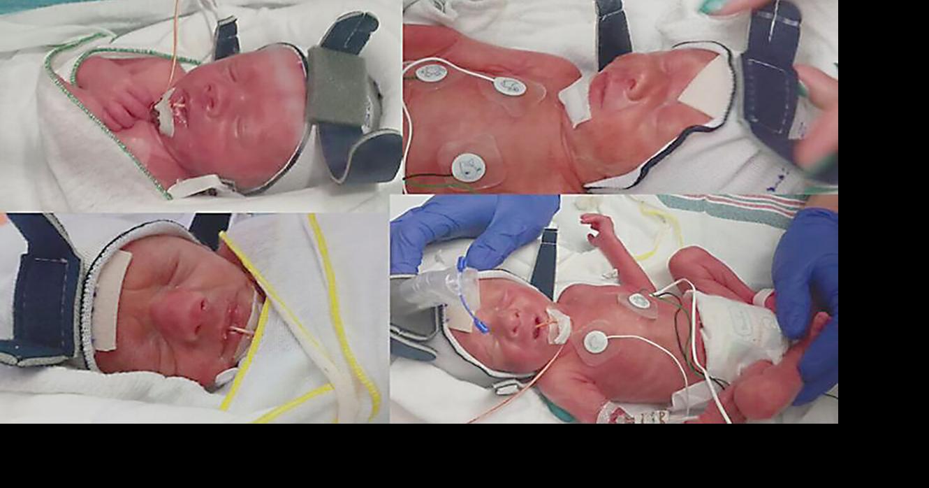 Phelps family has quadruplets News