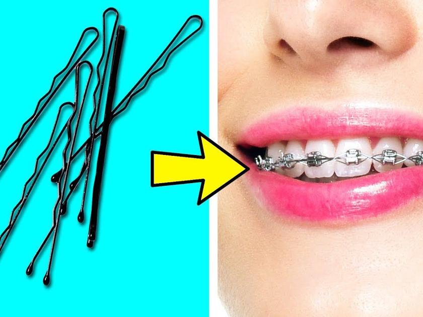 35 Brilliant Life S You Need To Know Fltimes Com - How To Make Diy Fake Braces