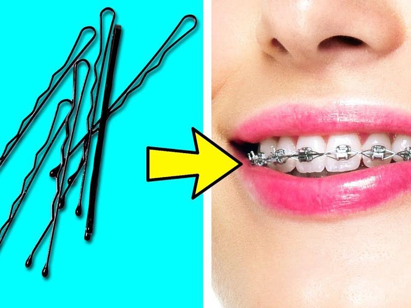 35 Brilliant Life S You Need To Know Fltimes Com - How To Make Diy Fake Braces 35 Brilliant Life S You Need To Know Fltimes Com - How To Make Diy Fake Braces