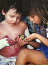 ebmrf skin disease