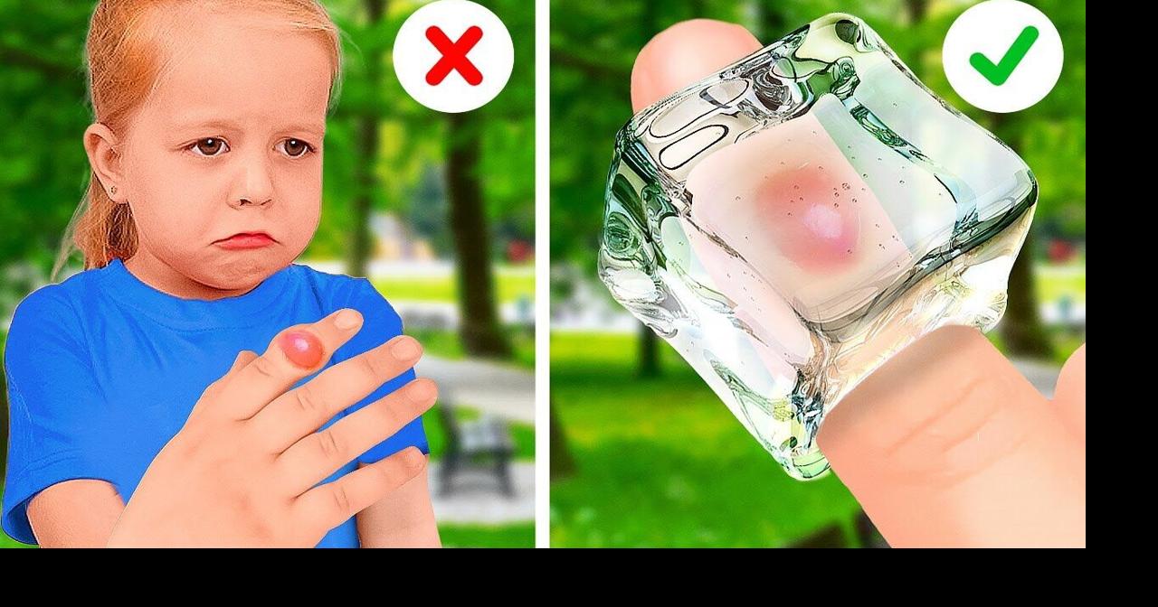 DIY Emergency Hacks For Smart Parents | Videos | fltimes.com