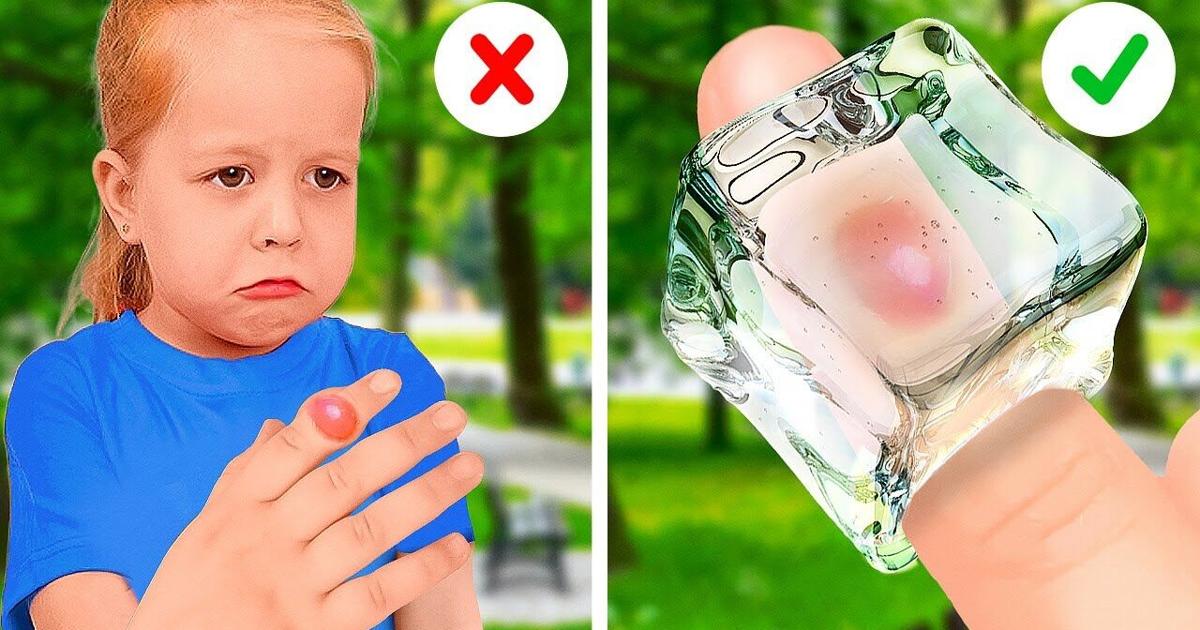 Emergency Hacks DIY Emergency Hacks For Smart Parents | Videos | fltimes.com