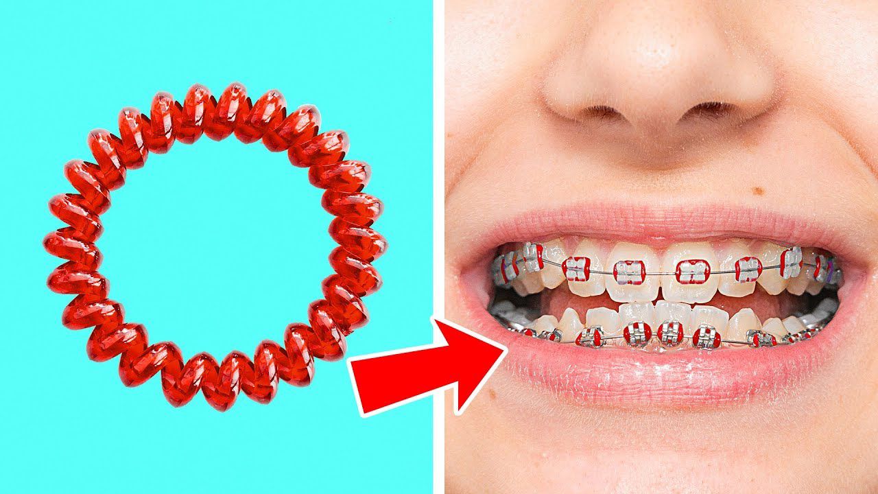 quail rubber bands braces