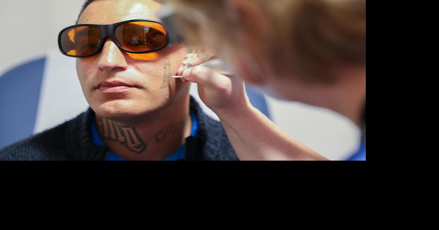 New tattoo removal program helps Inland Empire patients | Inland Empire News | fontanaheraldnews.com