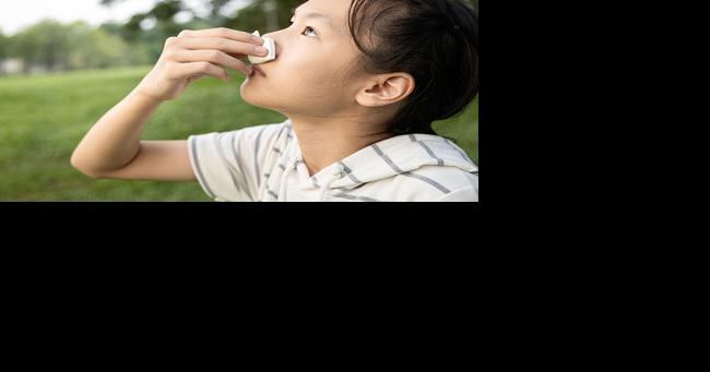 How to Stop a Nosebleed at Home - Vimarsana News