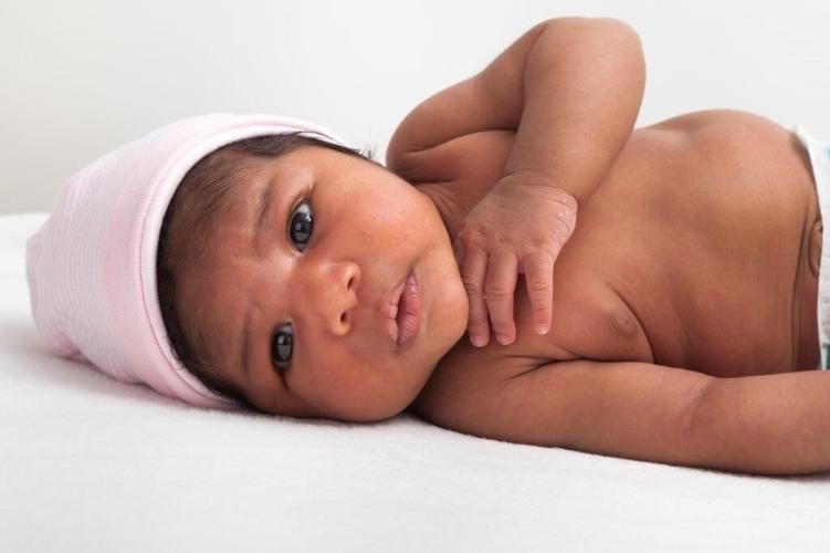 Ask Dr. Kevin: Debunking the Myths Around Sickle Cell Disease | Beauty ...