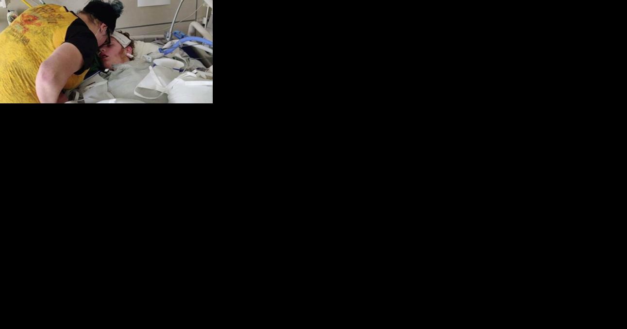 Child's legs amputated following strep infection | Health - Vimarsana News