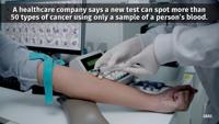 Researchers say new blood test can spot more than 50 types of cancer — many  hard to detect early - CBS News