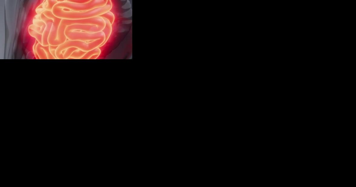 Colon Cancer cases going undetected causing more deaths | News - Vimarsana News