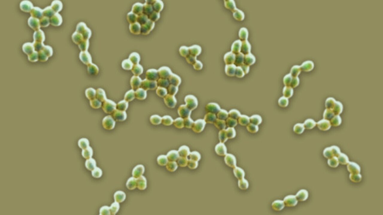 necrotizing fasciitis bacteria structure