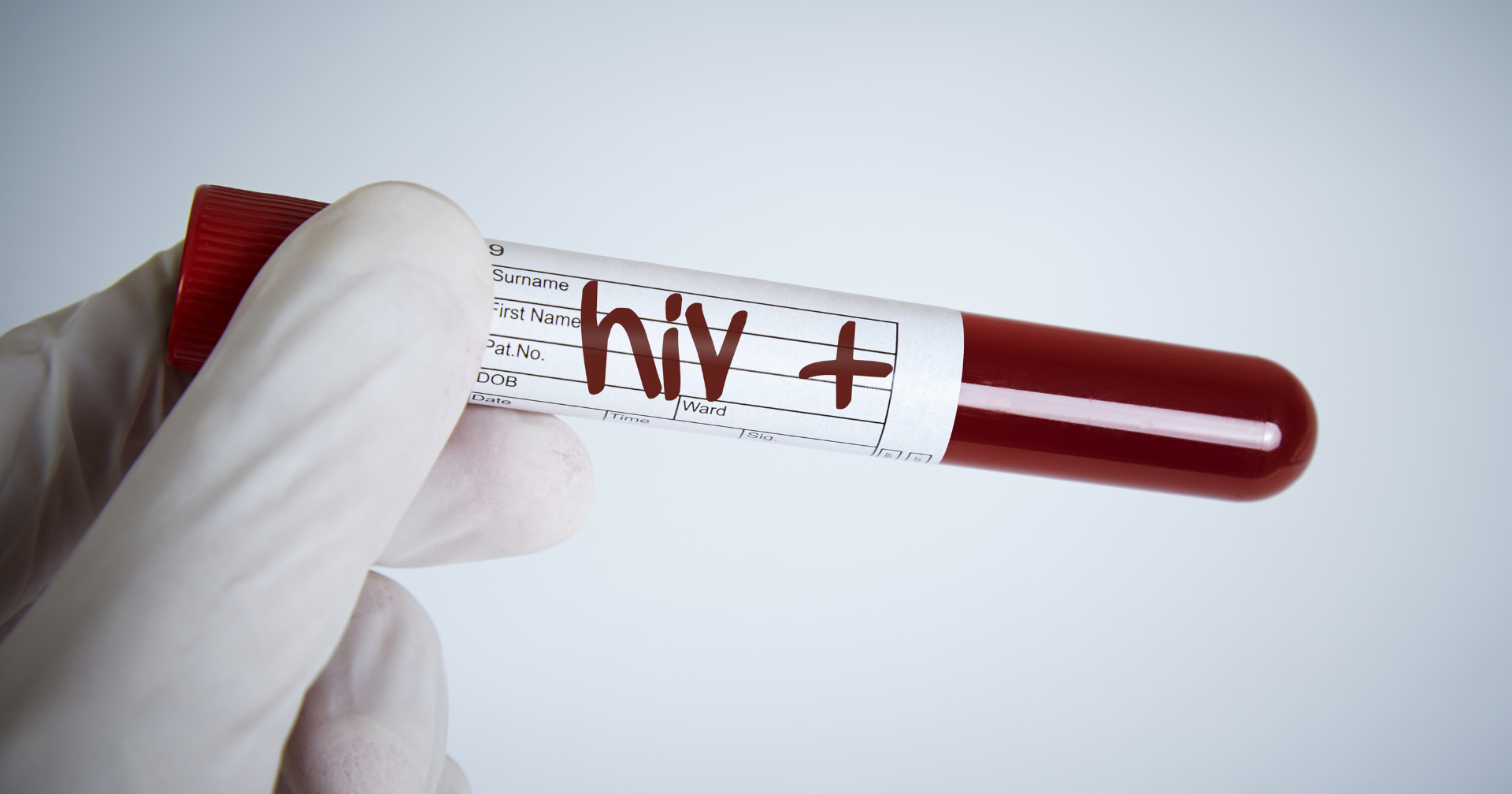 Experts weigh in on increase of HIV cases among teens | Health - Vimarsana News