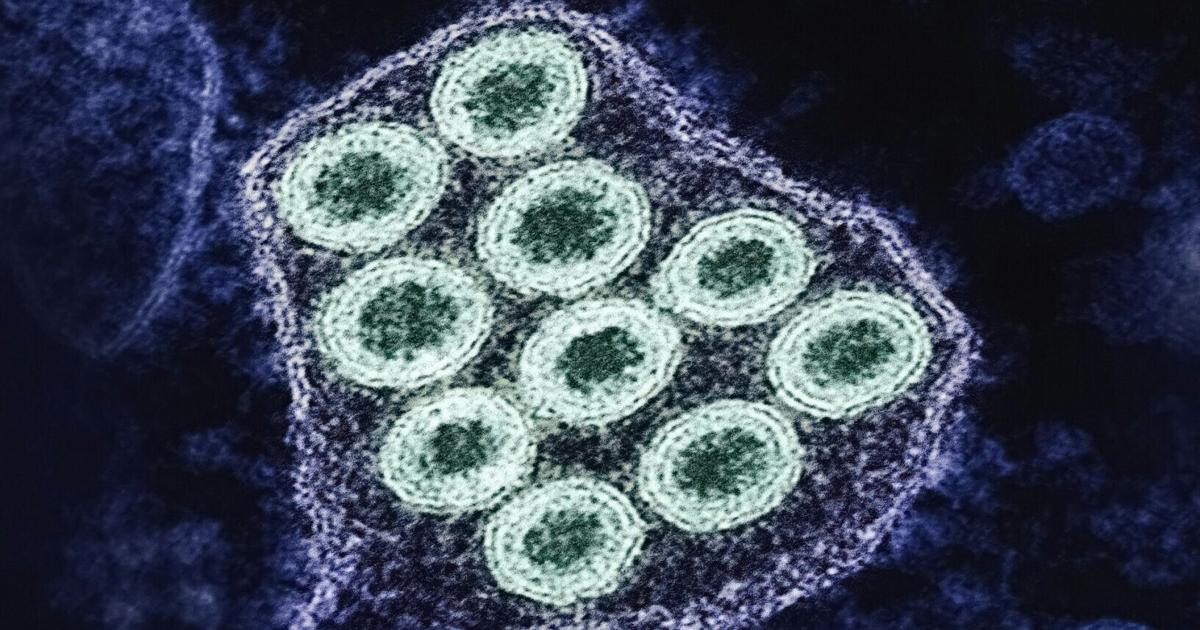 Doctors urge caution after rare rabies death in Canadian boy | Health Doctors urge caution after rare rabies death in Canadian boy | Health